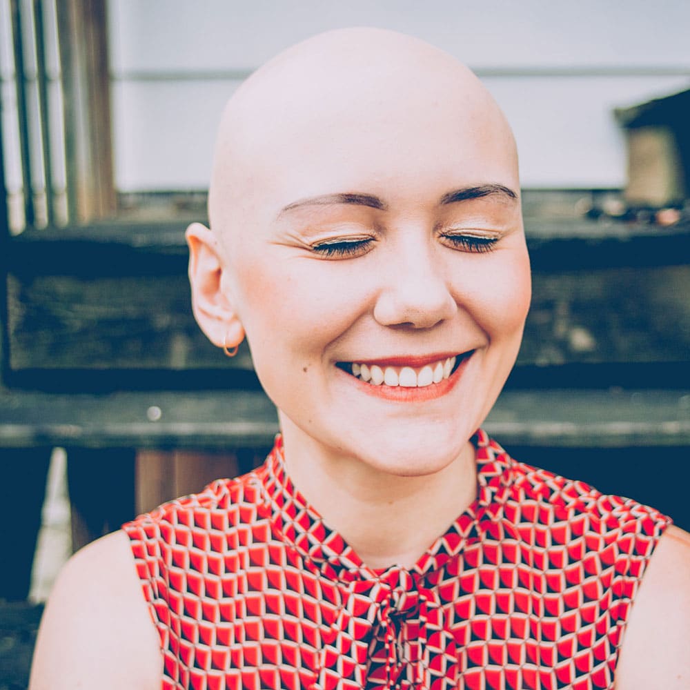 alopecia-small-2